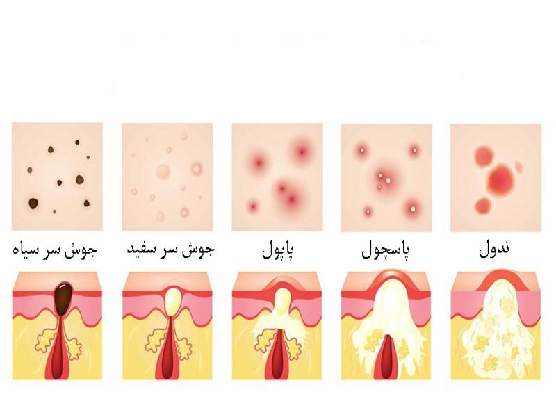 معرفی انواع جوش