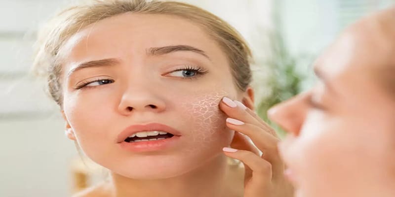 راه های بهبود پوست خشک