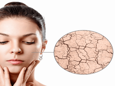 راه های بهبود پوست خشک