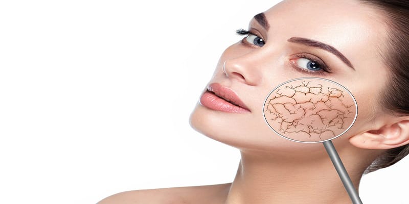 راه های بهبود پوست خشک
